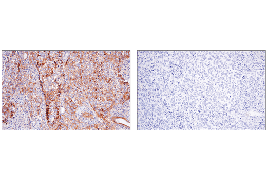 Immunohistochemistry Image 4: CD151 (E4I9J) XP® Rabbit mAb