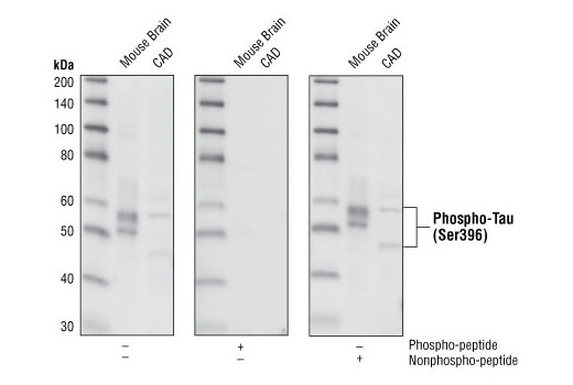  Image 8: Phospho-Tau Family Antibody Sampler Kit
