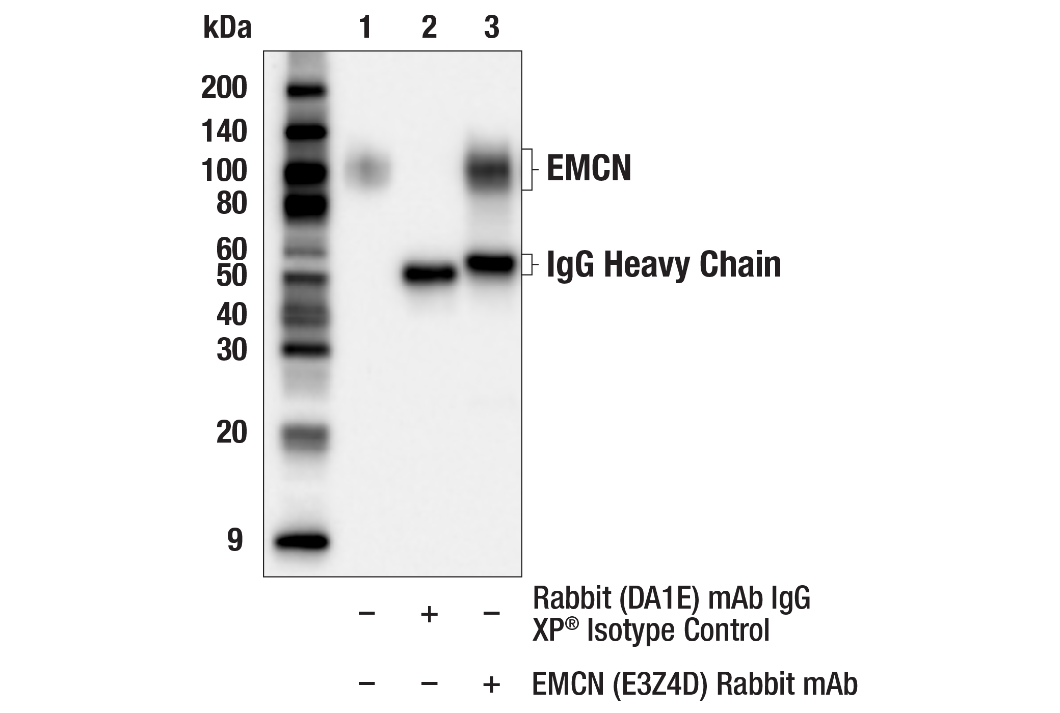 Immunoprecipitation Image 1: EMCN (E3Z4D) Rabbit mAb