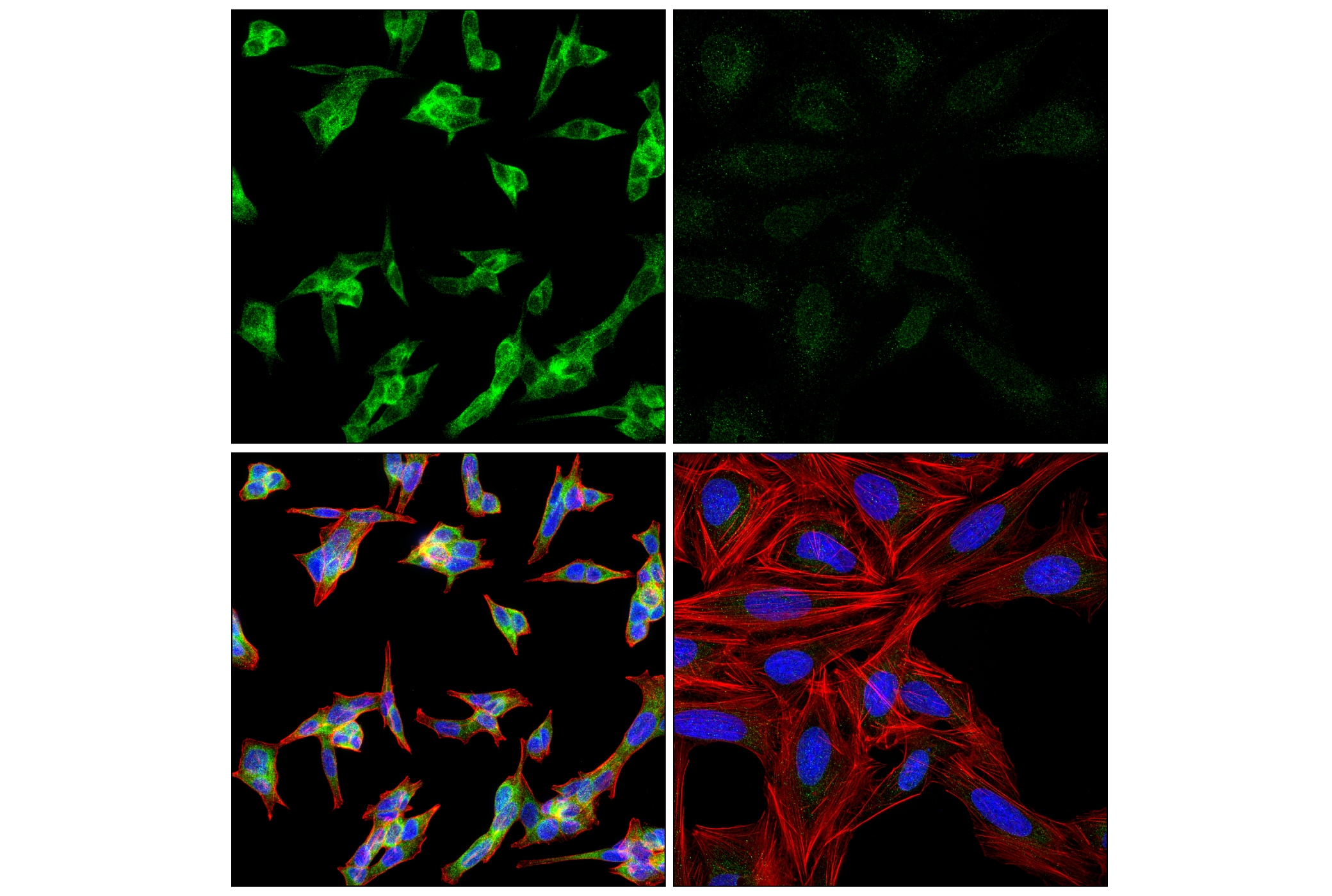 Immunofluorescence Image 3: UFL1 (F5P6L) Rabbit mAb