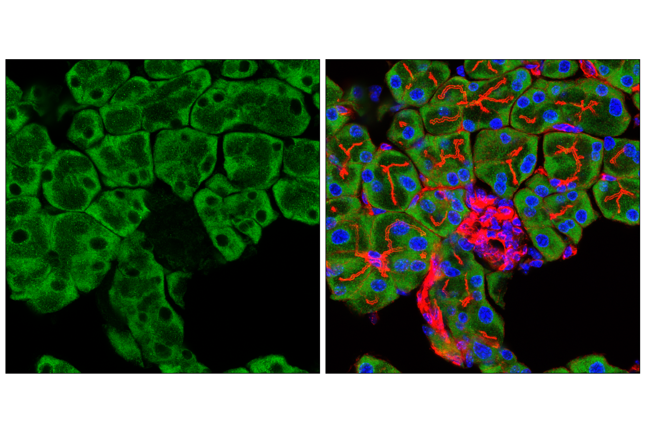 Immunofluorescence Image 2: UFL1 (F5P6L) Rabbit mAb
