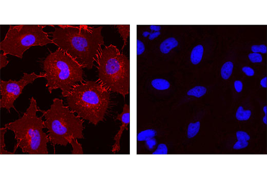 Immunofluorescence Image 1: Mouse (G3A1) mAb IgG1 Isotype Control (Alexa Fluor® 555 Conjugate)