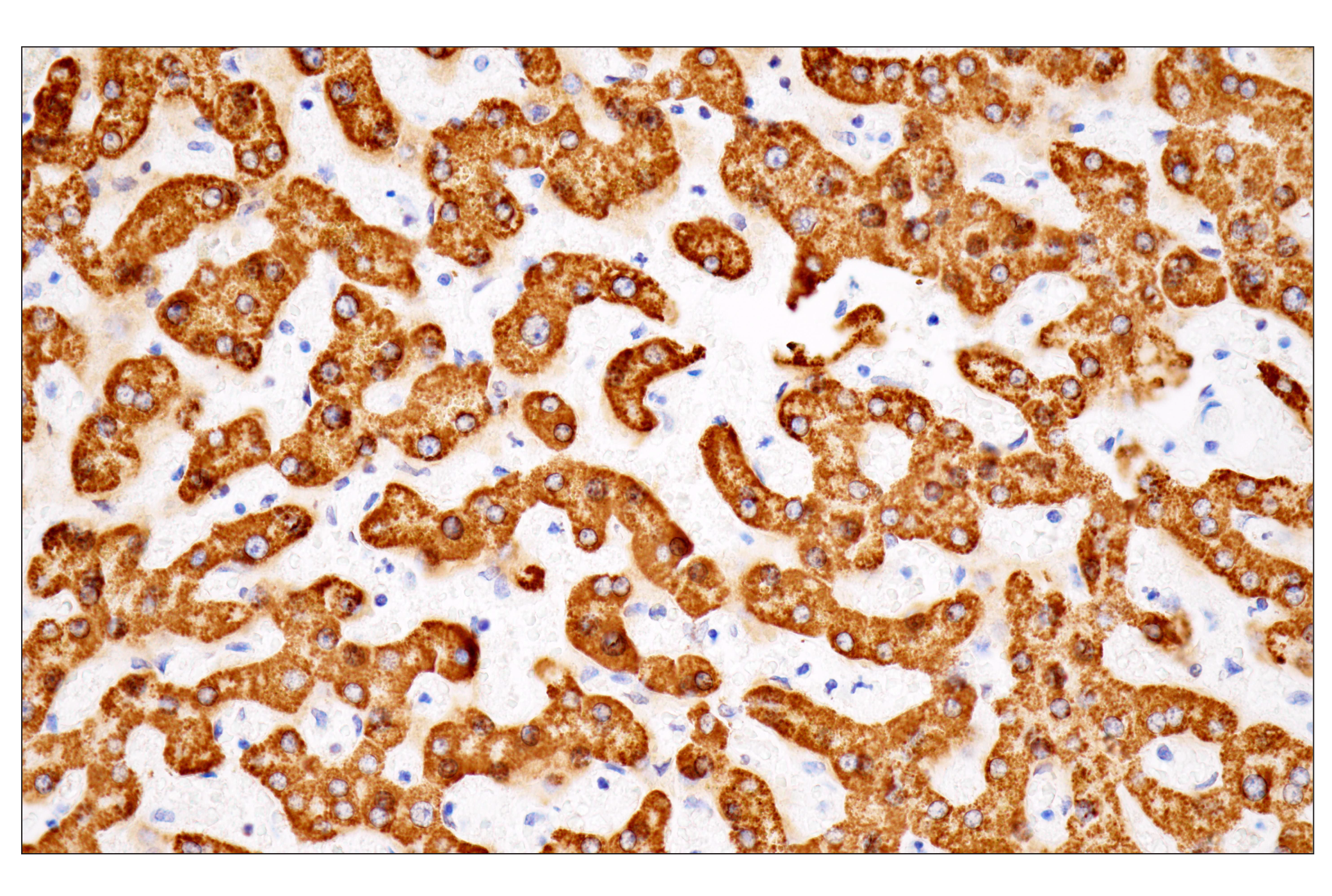 Immunohistochemistry Image 5: CPS1/Hep Par-1 (OCH1E5) Mouse mAb (Clone previously known as Hepatocyte Specific Antigen)