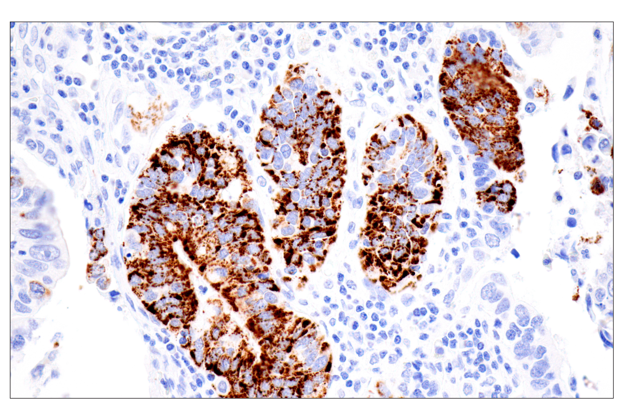 Immunohistochemistry Image 4: CPS1/Hep Par-1 (OCH1E5) Mouse mAb (Clone previously known as Hepatocyte Specific Antigen)