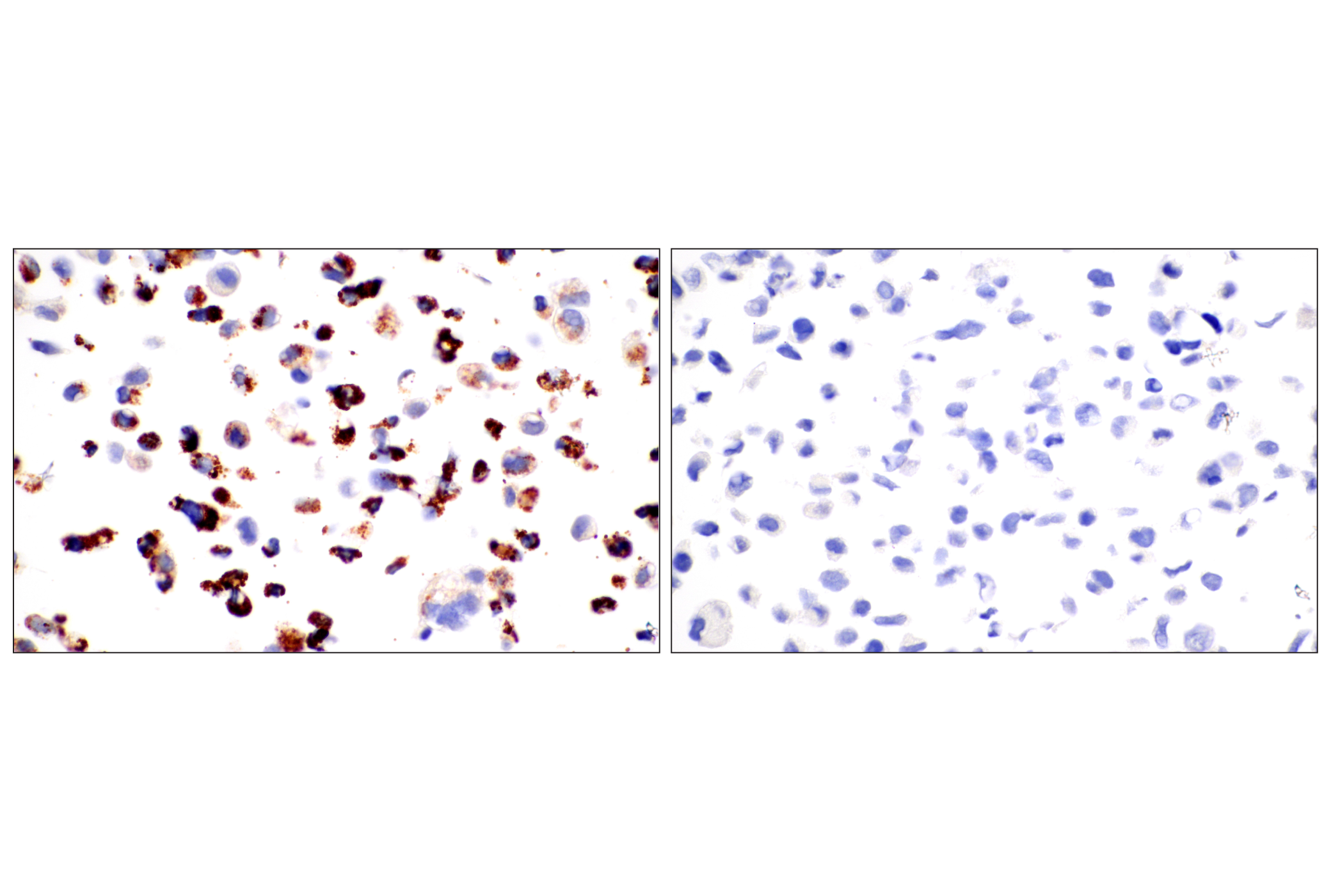 Immunohistochemistry Image 8: CPS1/Hep Par-1 (OCH1E5) Mouse mAb (Clone previously known as Hepatocyte Specific Antigen)