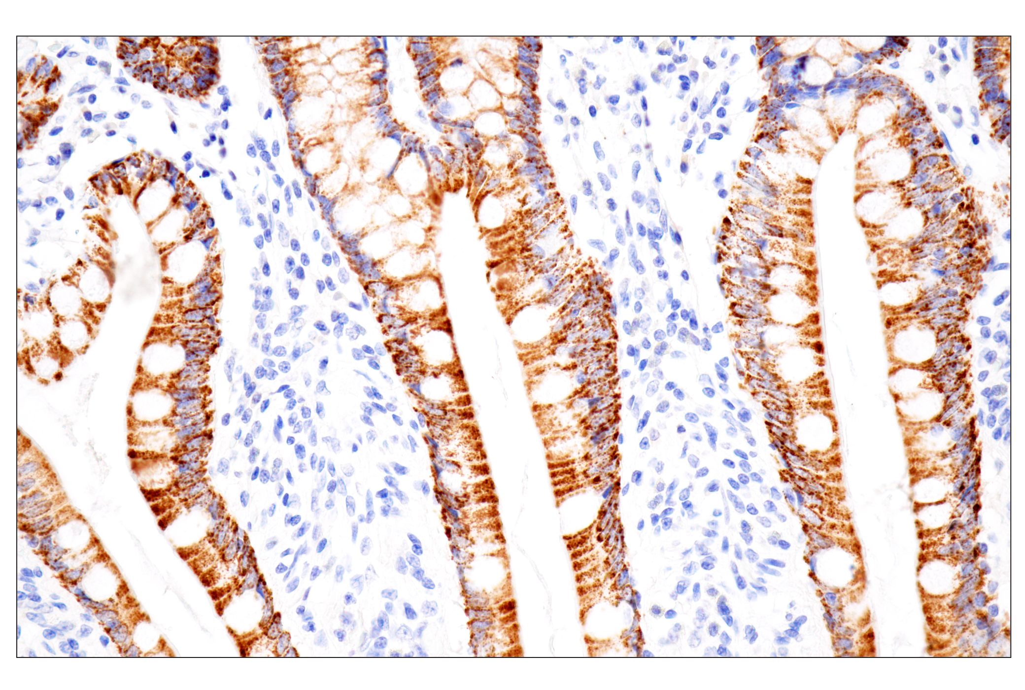 Immunohistochemistry Image 6: CPS1/Hep Par-1 (OCH1E5) Mouse mAb (Clone previously known as Hepatocyte Specific Antigen)