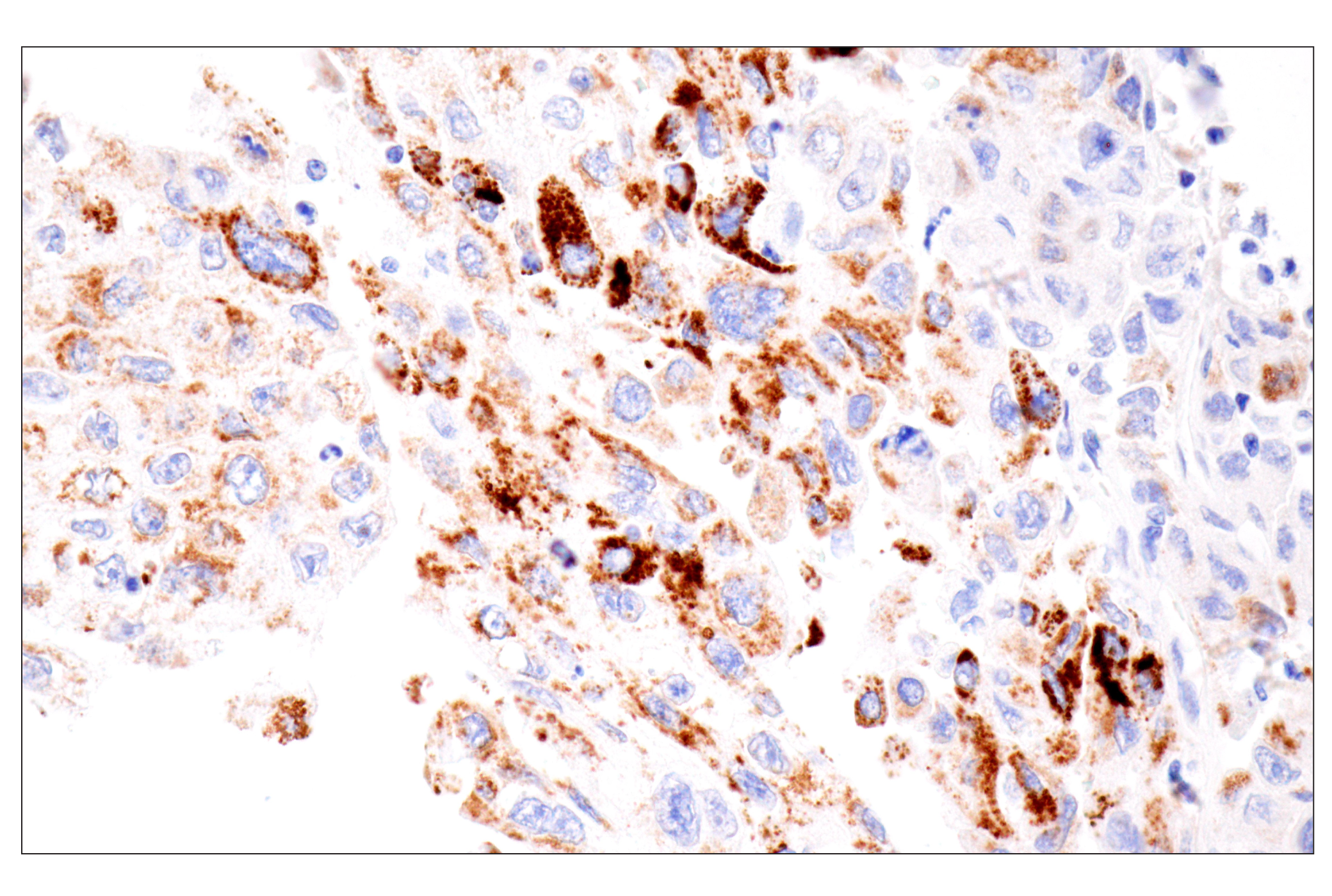 Immunohistochemistry Image 3: CPS1/Hep Par-1 (OCH1E5) Mouse mAb (Clone previously known as Hepatocyte Specific Antigen)
