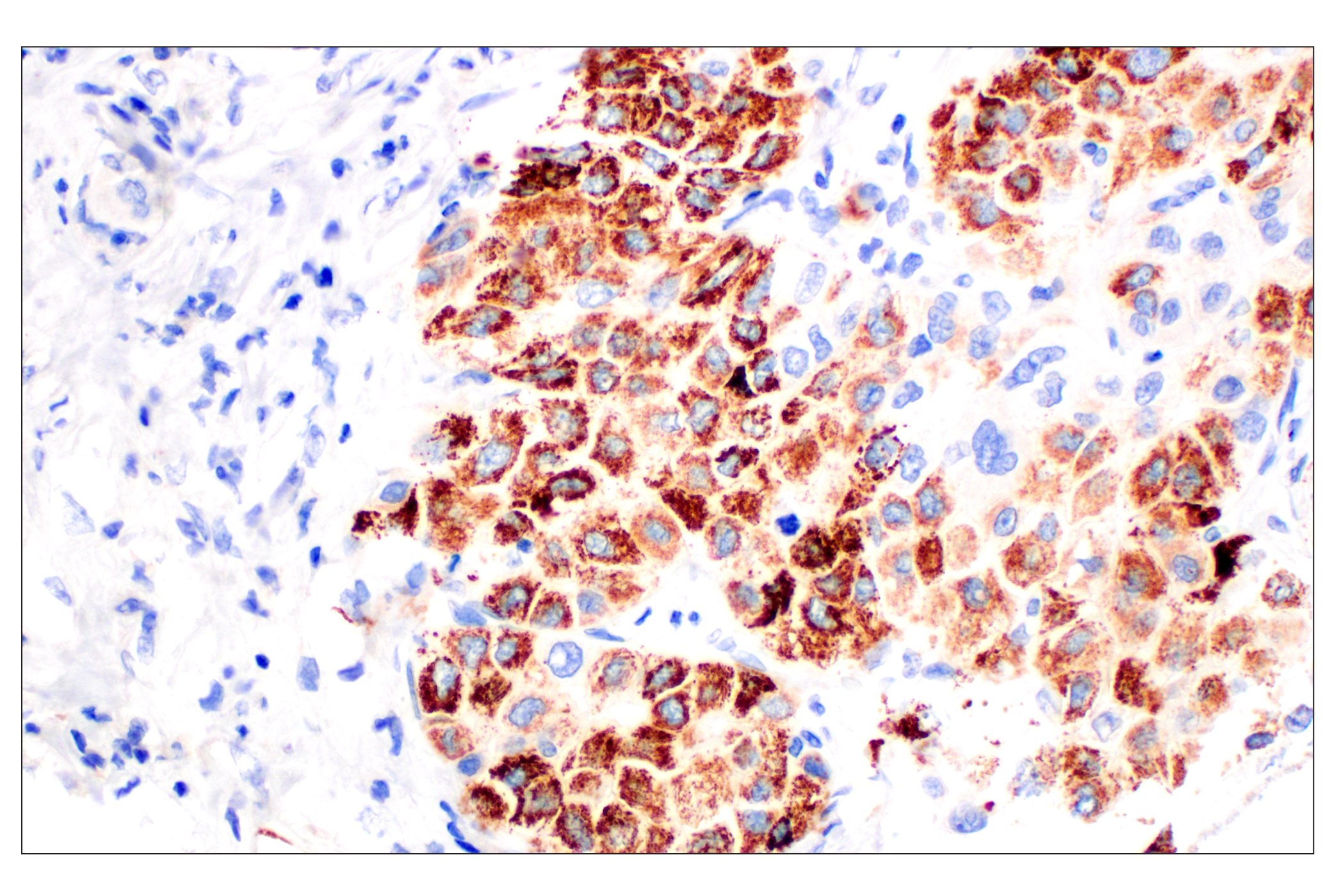 Immunohistochemistry Image 1: CPS1/Hep Par-1 (OCH1E5) Mouse mAb (Clone previously known as Hepatocyte Specific Antigen)