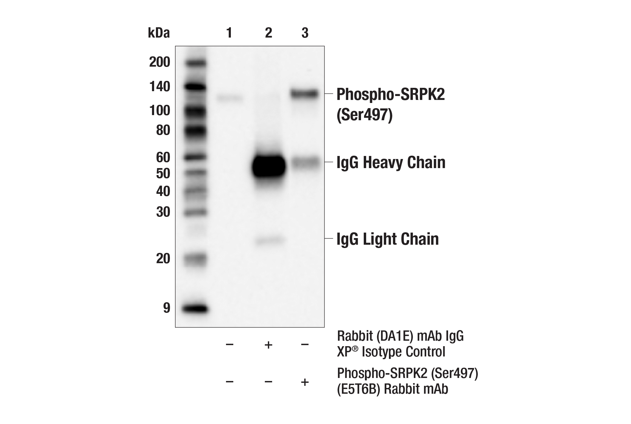 Immunoprecipitation Image 1: Phospho-SRPK2 (Ser497) (E5T6B) Rabbit mAb