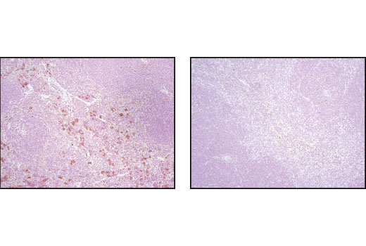 Immunohistochemistry Image 4: 4E-BP1 (53H11) Rabbit mAb