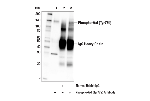 Immunoprecipitation Image 1: Phospho-Axl (Tyr779) Antibody