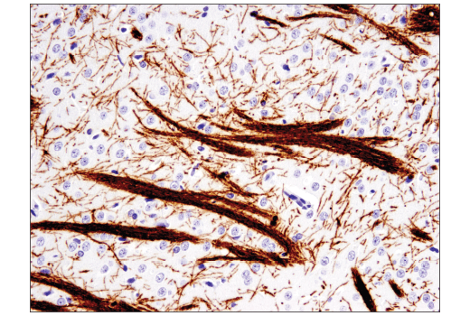  Image 36: Oligodendrocyte Marker Antibody Sampler Kit