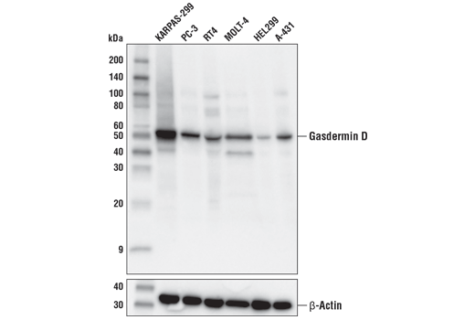 Western Blotting Image 3: Gasdermin D Antibody