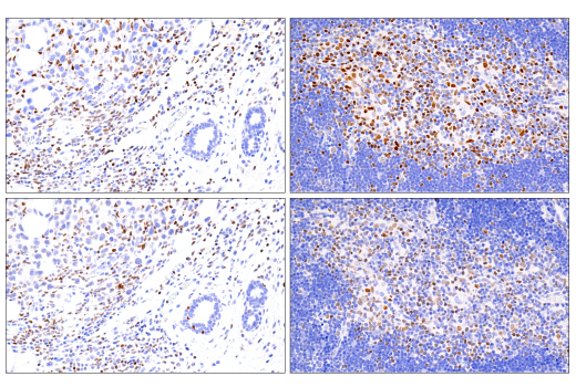 Immunohistochemistry Image 5: RUNX3/AML2 (D6E2) Rabbit mAb
