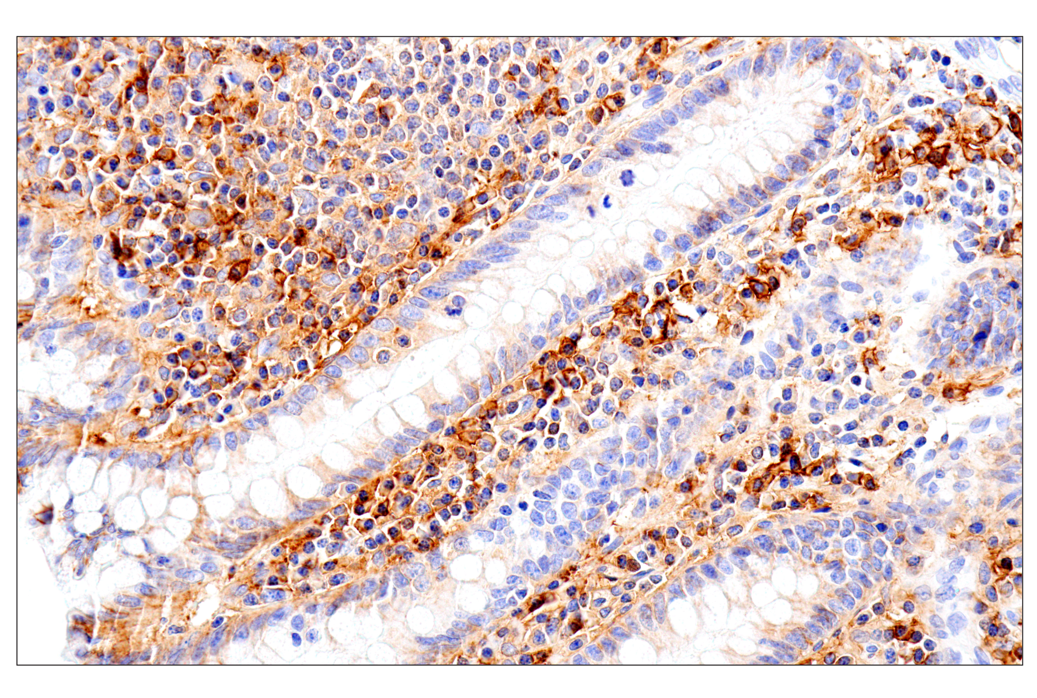 Immunohistochemistry Image 15: Syndecan 1 (E7F7T) Rabbit mAb