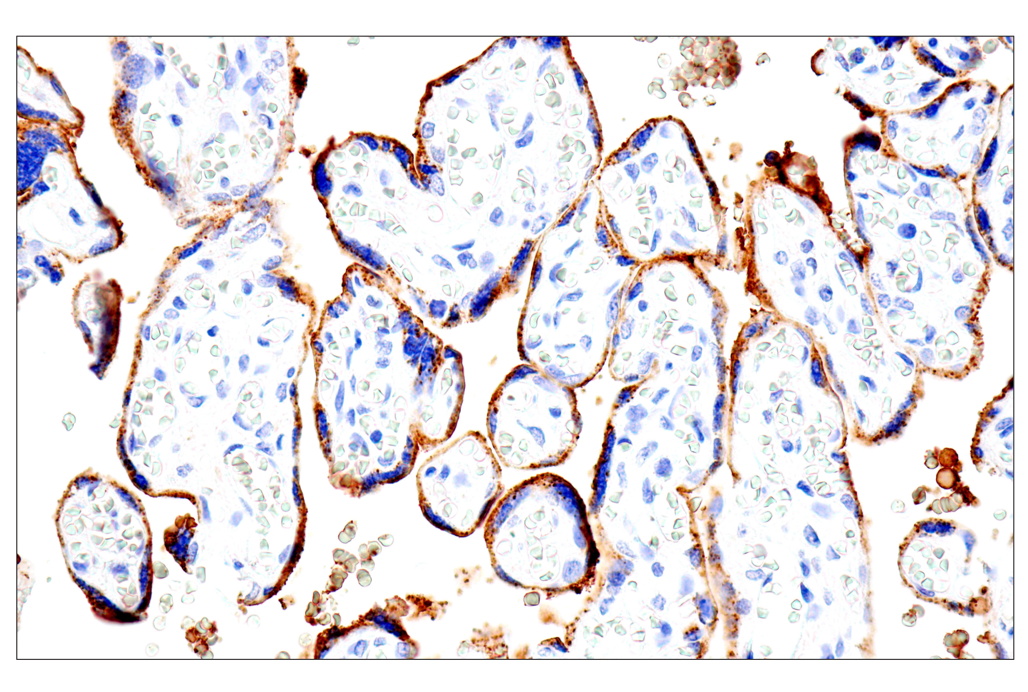Immunohistochemistry Image 12: Syndecan 1 (E7F7T) Rabbit mAb