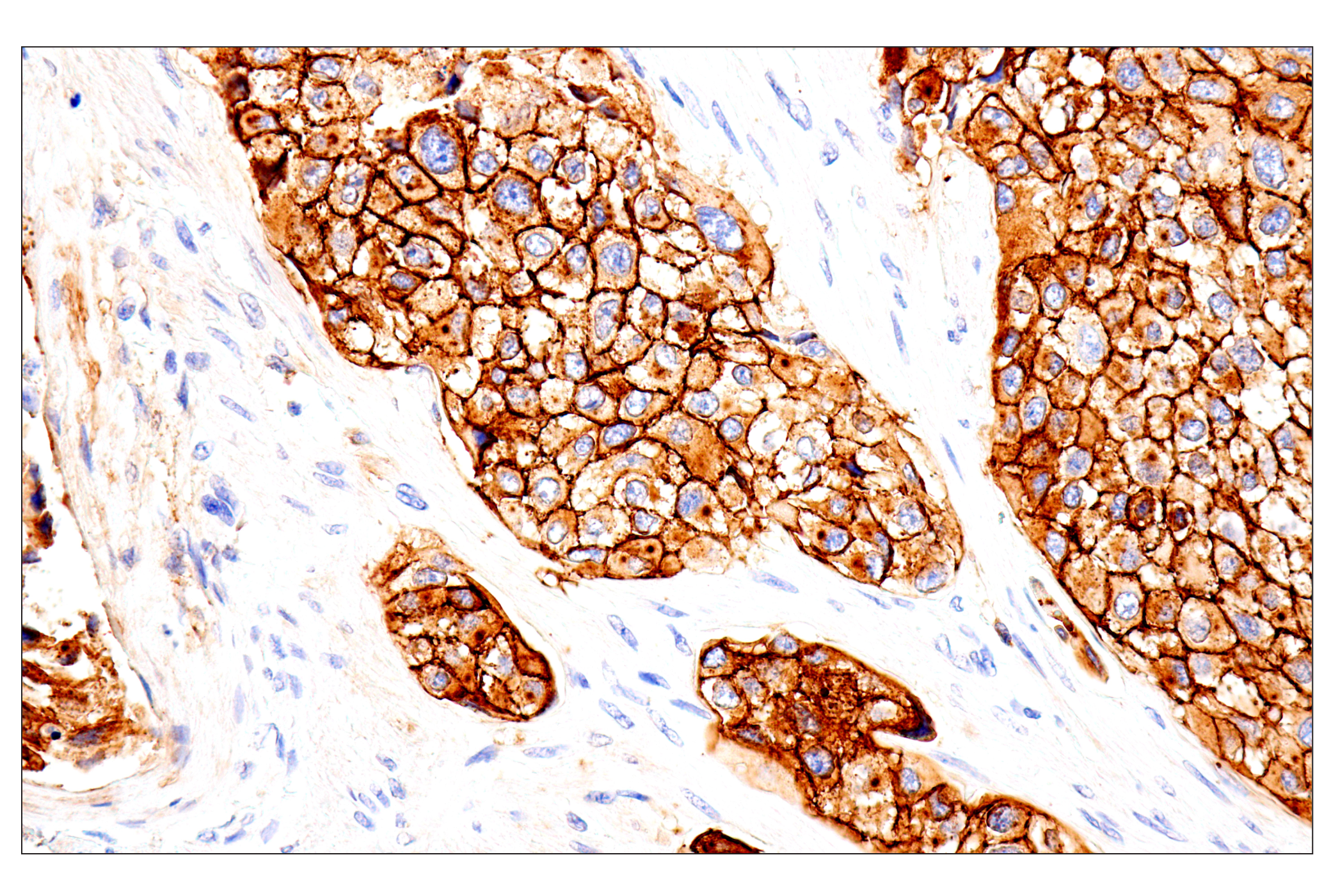 Immunohistochemistry Image 7: Syndecan 1 (E7F7T) Rabbit mAb