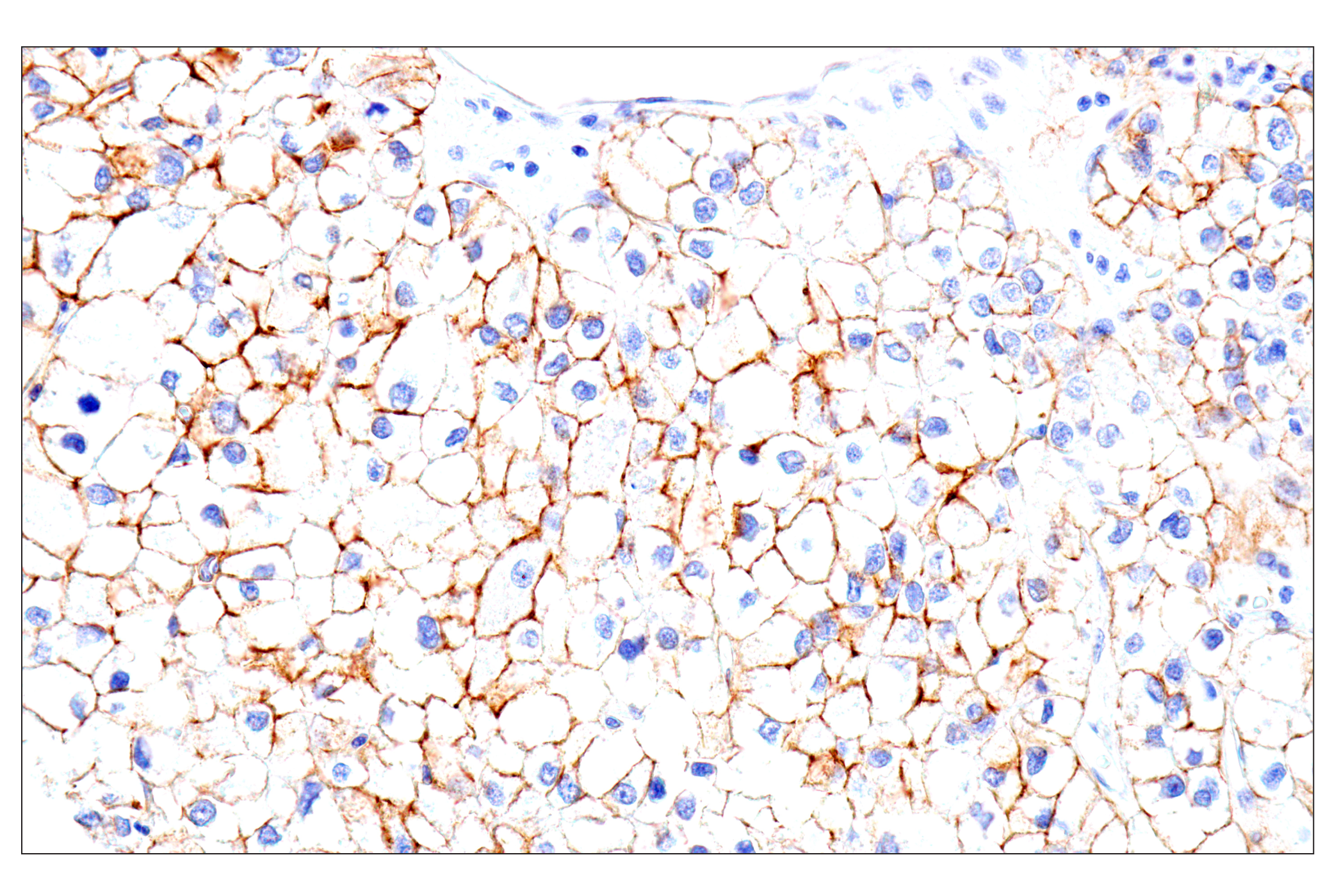 Immunohistochemistry Image 6: Syndecan 1 (E7F7T) Rabbit mAb