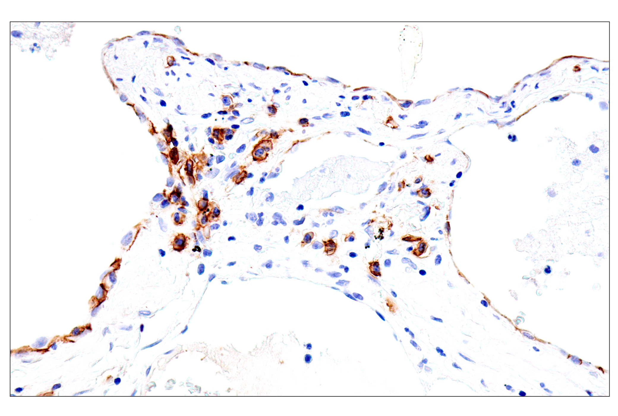 Immunohistochemistry Image 5: Syndecan 1 (E7F7T) Rabbit mAb