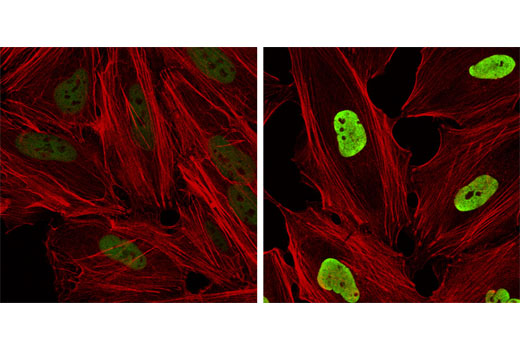 Immunofluorescence Image 1: Acetyl-Histone H3 (Lys9) (C5B11) Rabbit mAb