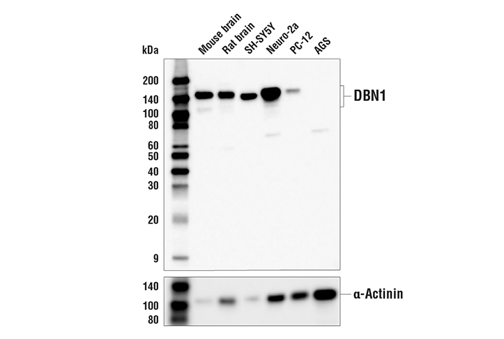 Western Blotting Image 1: DBN1 Antibody