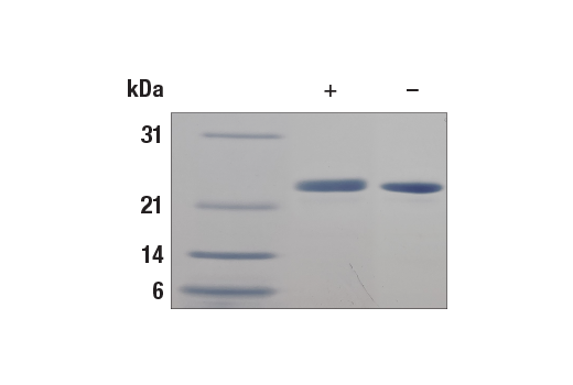  Image 2: Human FGF-21 Recombinant Protein
