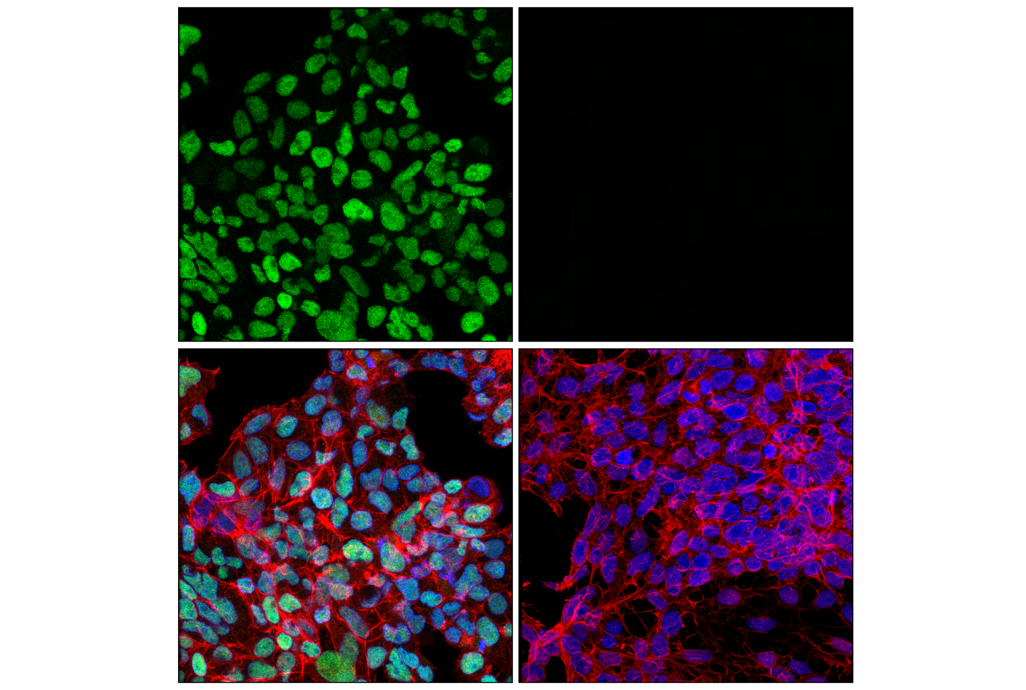Immunofluorescence Image 2: DLX1 (E4T1L) Rabbit mAb