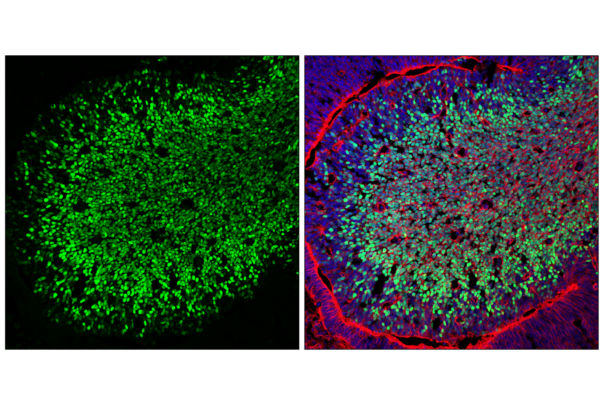 Immunofluorescence Image 1: DLX1 (E4T1L) Rabbit mAb