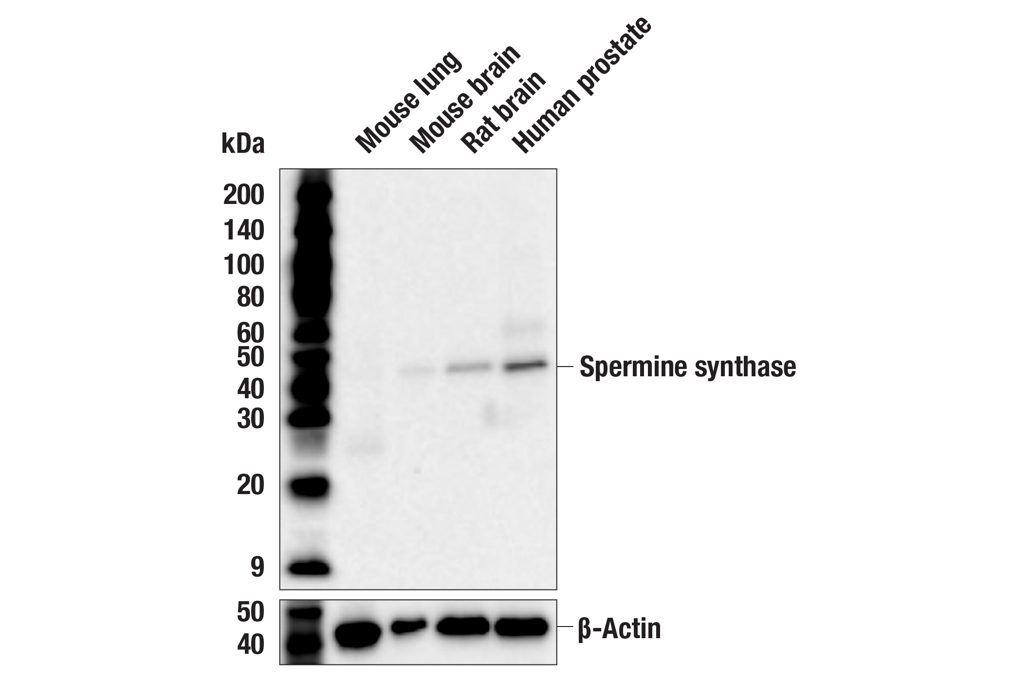 Western Blotting Image 2: Spermine synthase (F9W1S) Rabbit mAb