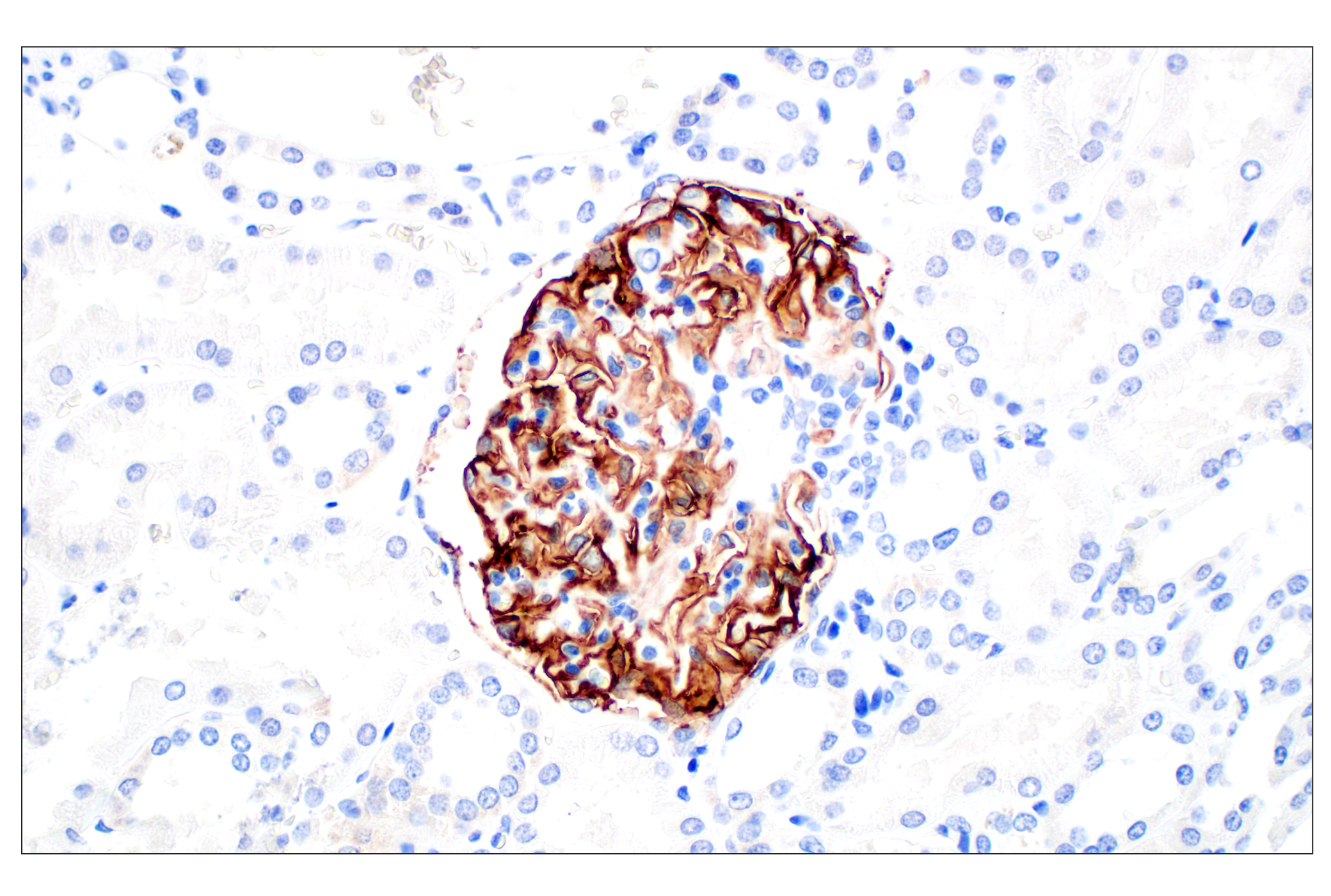 Immunohistochemistry Image 3: CR1/CD35 (E8B1Z) Rabbit mAb
