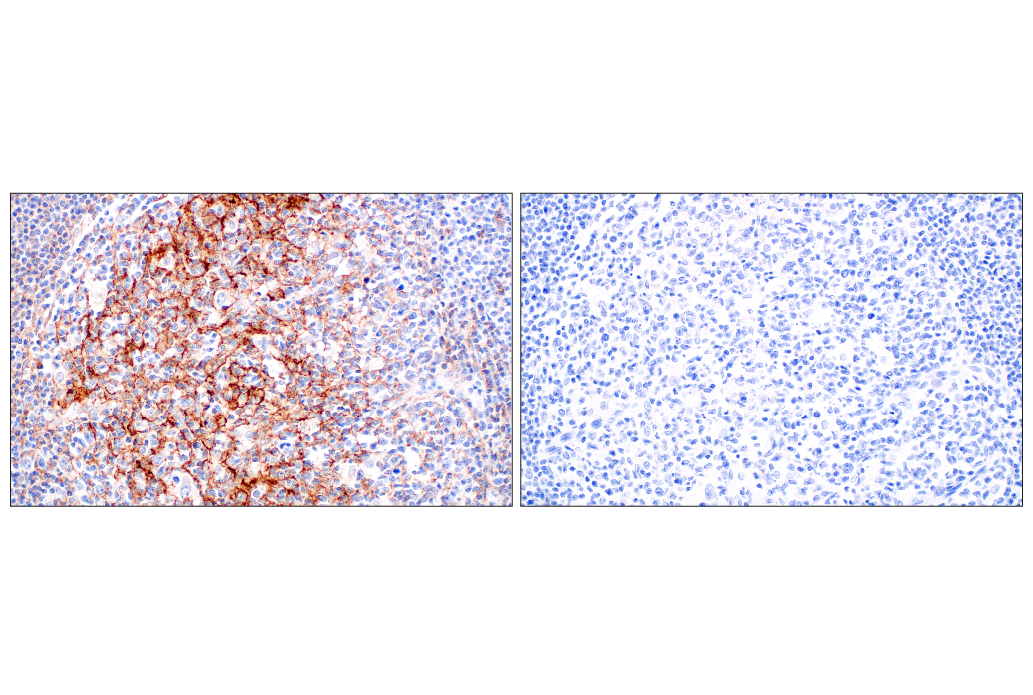 Immunohistochemistry Image 5: CR1/CD35 (E8B1Z) Rabbit mAb