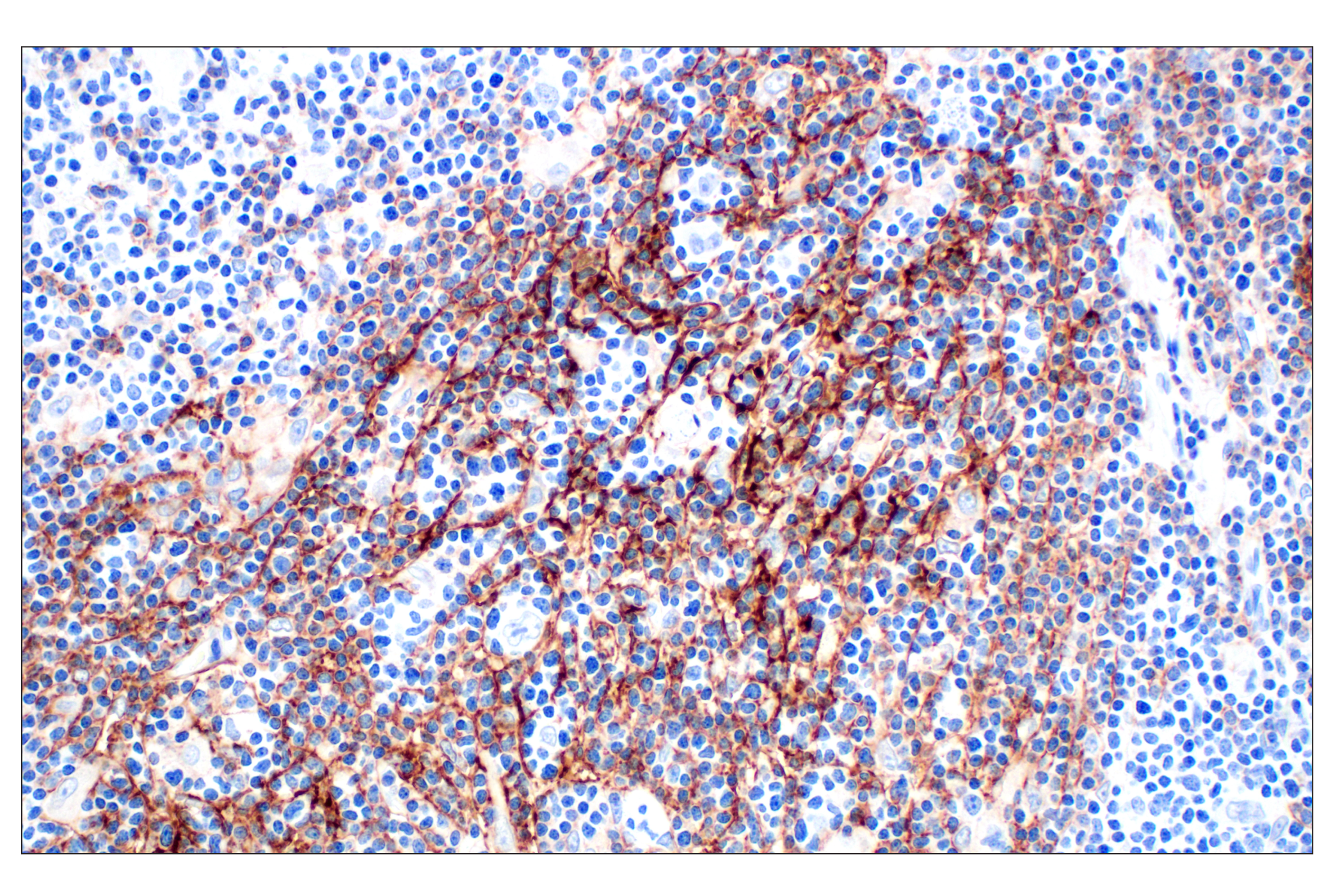 Immunohistochemistry Image 1: CR1/CD35 (E8B1Z) Rabbit mAb
