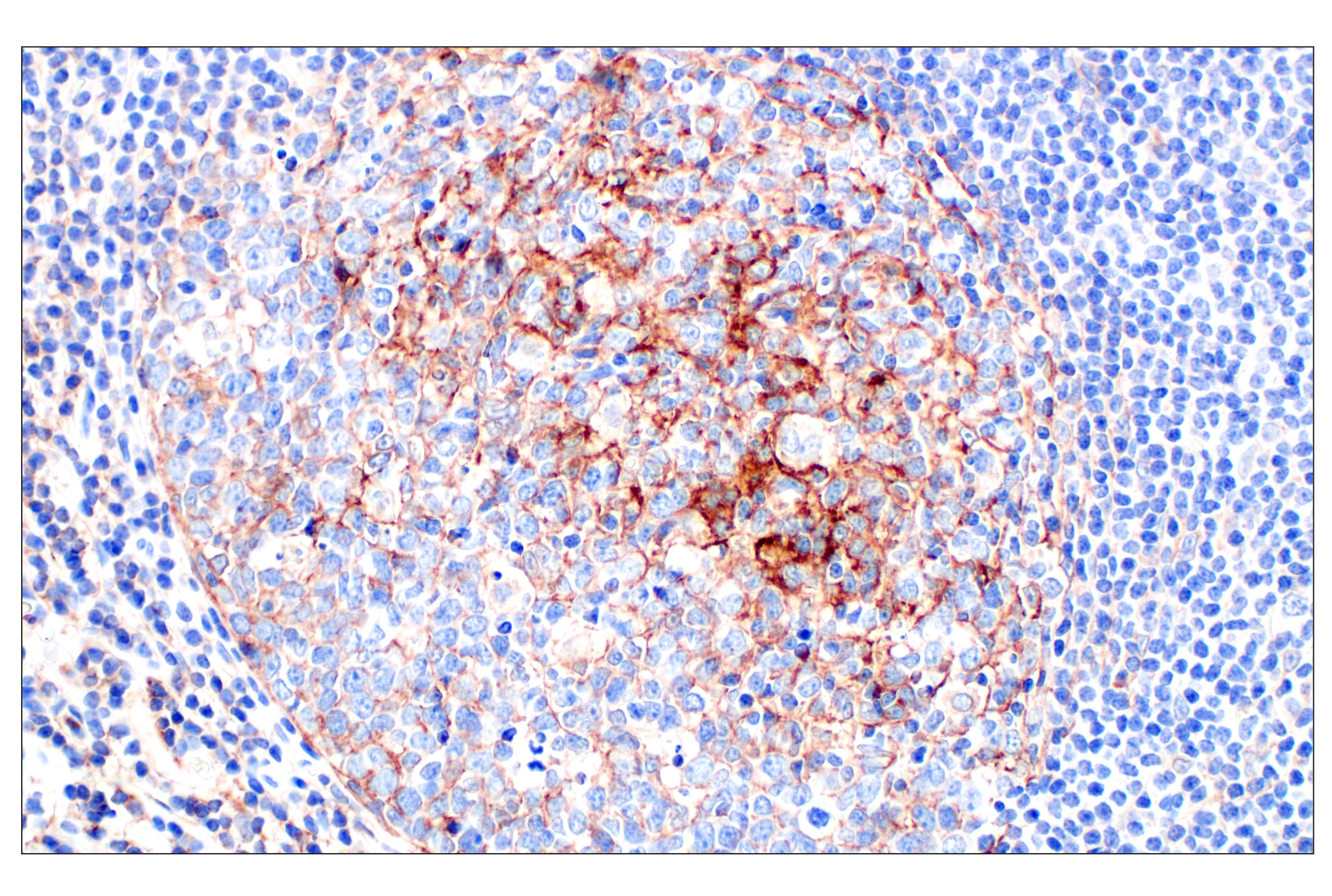 Immunohistochemistry Image 4: CR1/CD35 (E8B1Z) Rabbit mAb