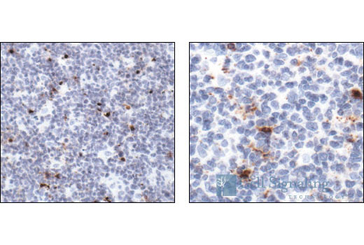  Image 19: β-Amyloid Mouse Model Neuronal Viability IF Antibody Sampler Kit
