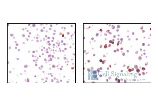  Image 27: β-Amyloid Mouse Model Neuronal Viability IF Antibody Sampler Kit