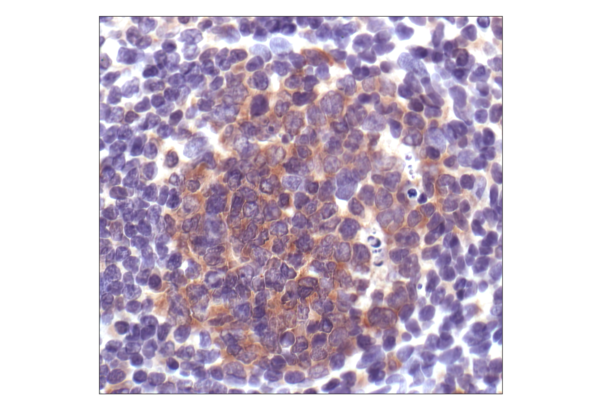 Immunohistochemistry Image 1: Caspase-3 Antibody