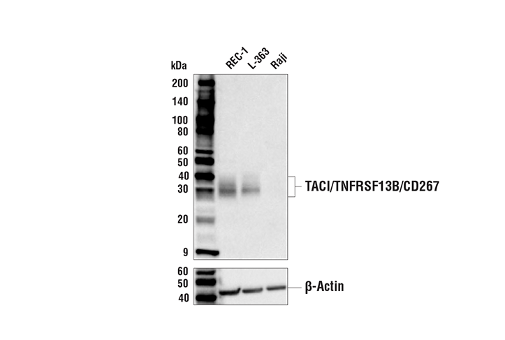Western Blotting Image 1: TACI/TNFRSF13B/CD267 (E1D1P) Rabbit mAb