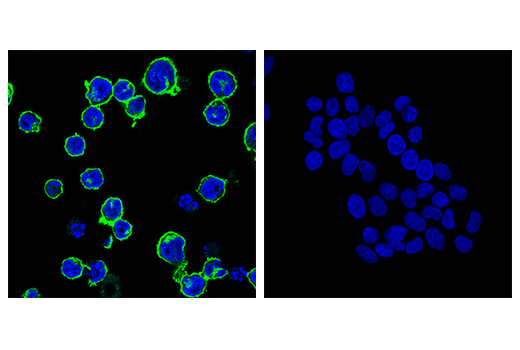 Immunofluorescence Image 1: TACI/TNFRSF13B/CD267 (E1D1P) Rabbit mAb