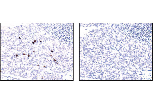 Immunohistochemistry Image 1: Cleaved Caspase-3 (Asp175) (5A1E) Rabbit mAb