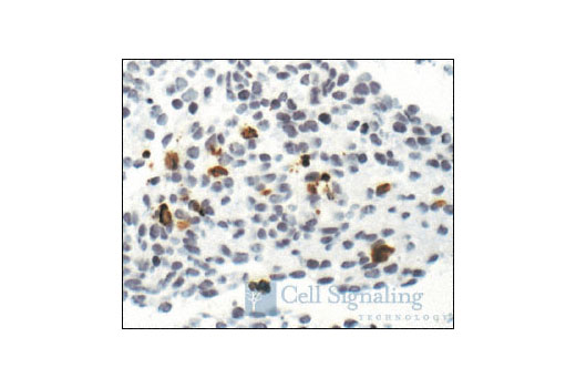 Immunohistochemistry Image 3: Cleaved Caspase-3 (Asp175) (5A1E) Rabbit mAb