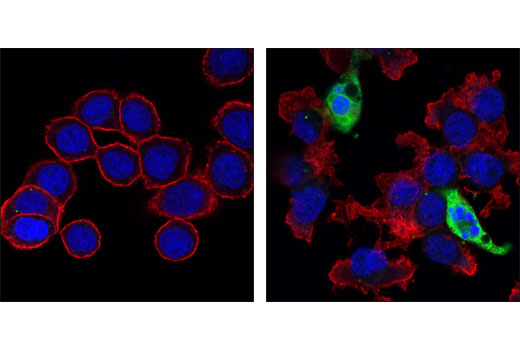  Image 56: Human Reactive Cell Death and Autophagy Antibody Sampler Kit