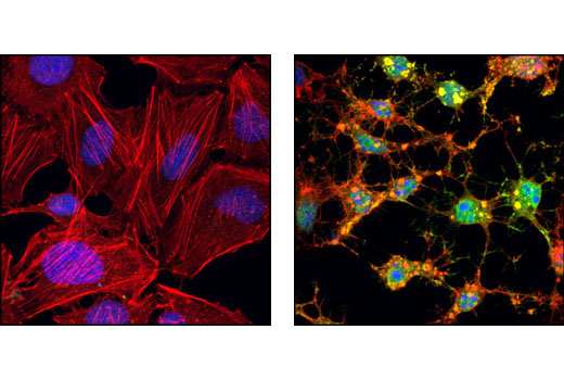 Immunofluorescence Image 1: Cleaved Caspase-3 (Asp175) Antibody (Alexa Fluor® 488 Conjugate)