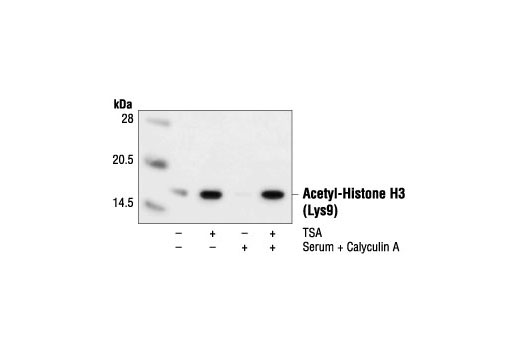 Western Blotting Image 1: Acetyl-Histone H3 (Lys9) Antibody