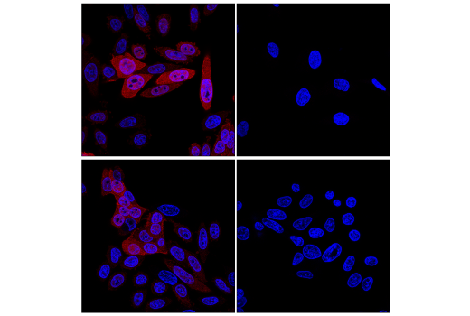 Immunofluorescence Image 2: Non-phospho (Active) β-Catenin (Ser45) (D2U8Y) XP® Rabbit mAb (Alexa Fluor® 647 Conjugate)