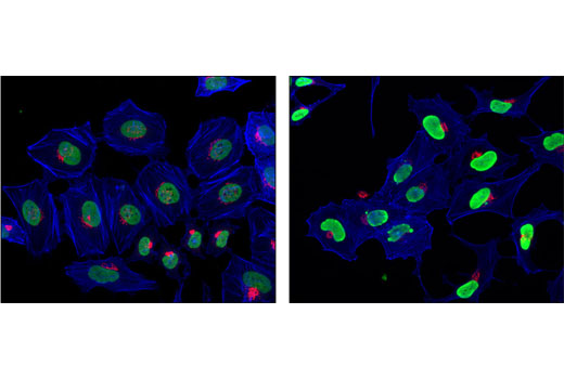Immunofluorescence Image 1: Acetyl-Histone H4 (Lys5) Antibody