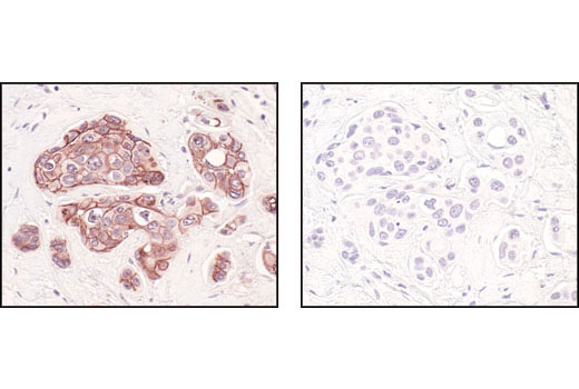 Immunohistochemistry Image 10: E-Cadherin (24E10) Rabbit mAb (BSA and Azide Free)