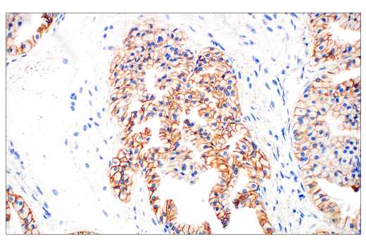Immunohistochemistry Image 5: E-Cadherin (24E10) Rabbit mAb (BSA and Azide Free)