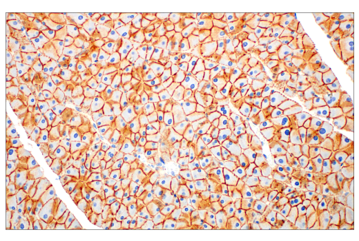 Immunohistochemistry Image 6: E-Cadherin (24E10) Rabbit mAb (BSA and Azide Free)
