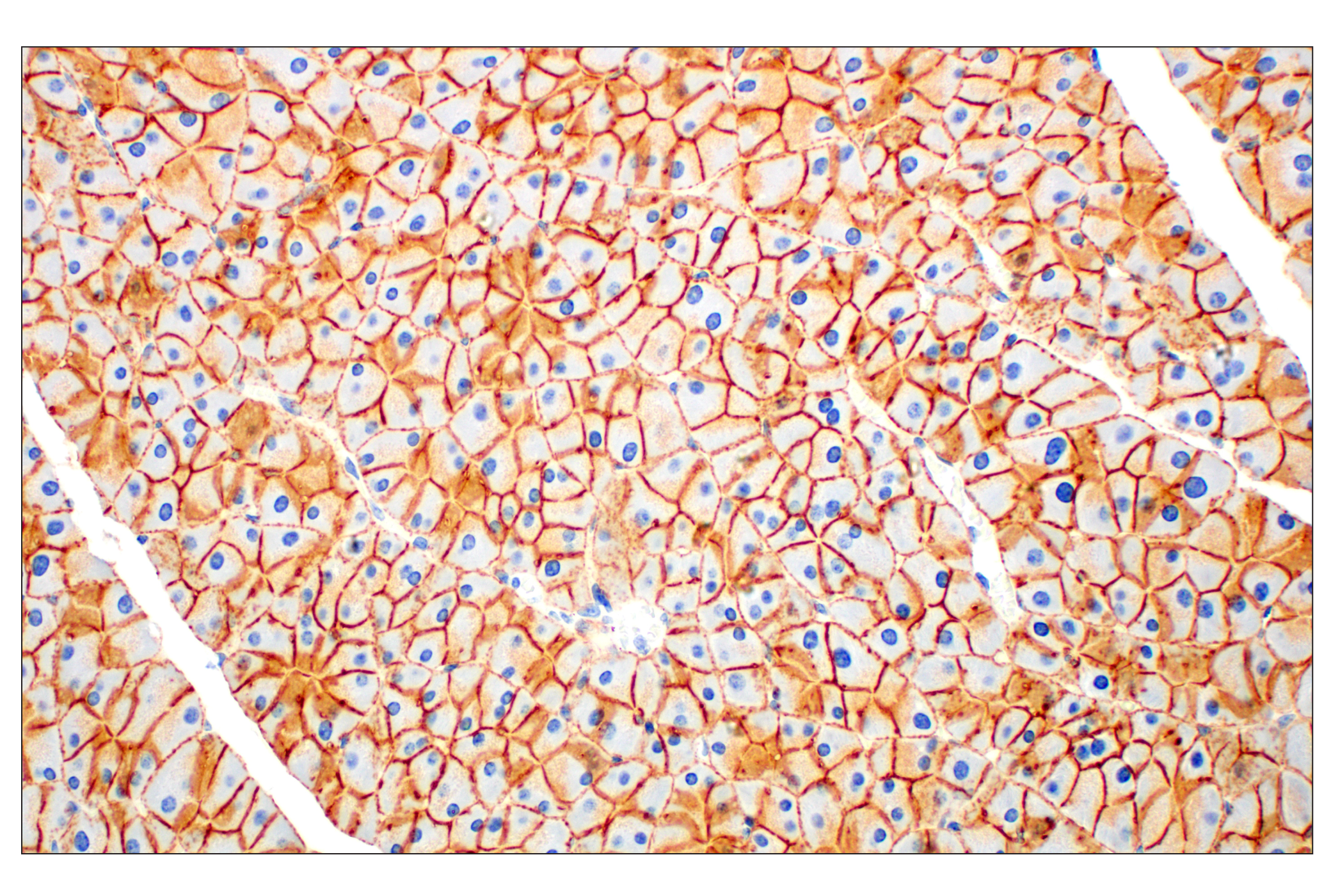Immunohistochemistry Image 6: E-Cadherin (24E10) Rabbit mAb (BSA and Azide Free)
