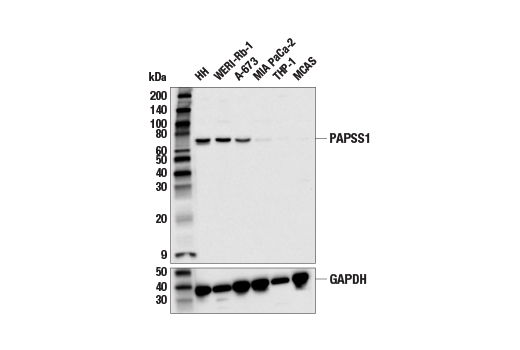 Western Blotting Image 1: PAPSS1 Antibody